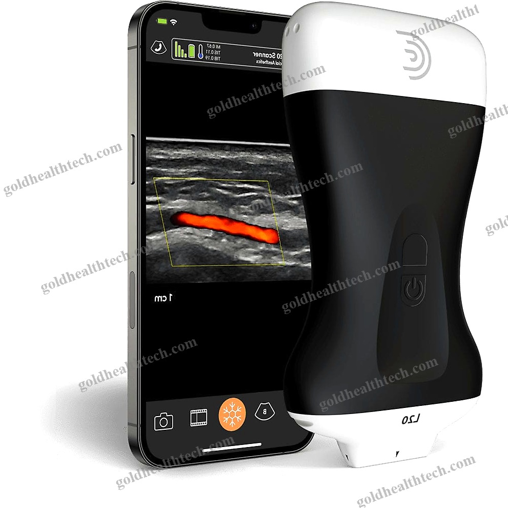 Hand-Held Ultrasound System