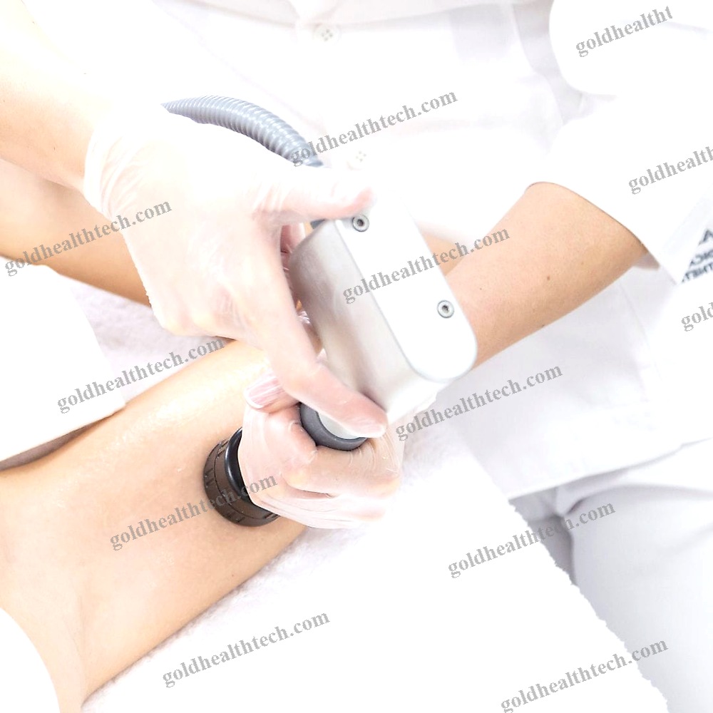 Aesthetic Medicine Extra-Corporeal Shockwave Therapy System